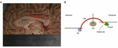 Awakening Neuropsychiatric Research Into the Stria Medullaris: Development of a Diffusion-Weighted Imaging Tractography Protocol of This Key Limbic Structure